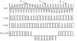 sinusoidal-pwm-.jpg